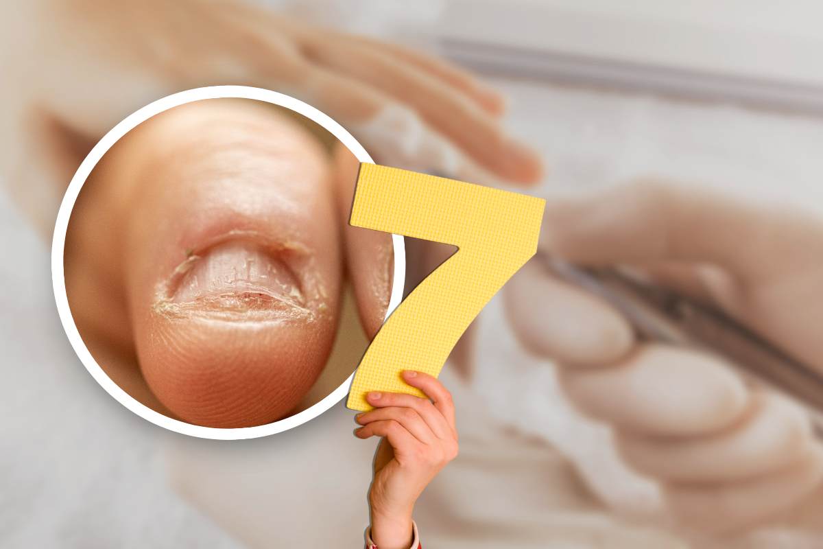 Onicofagia, 7 consigli per smettere di mangiarsi le unghie